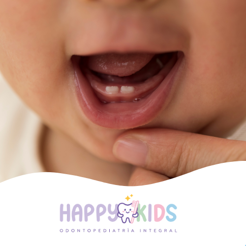 ¿Cuándo comenzar el cepillado de dientes?